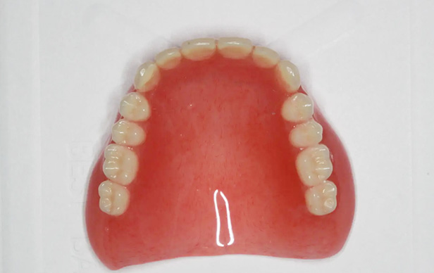 総入れ歯（保険）